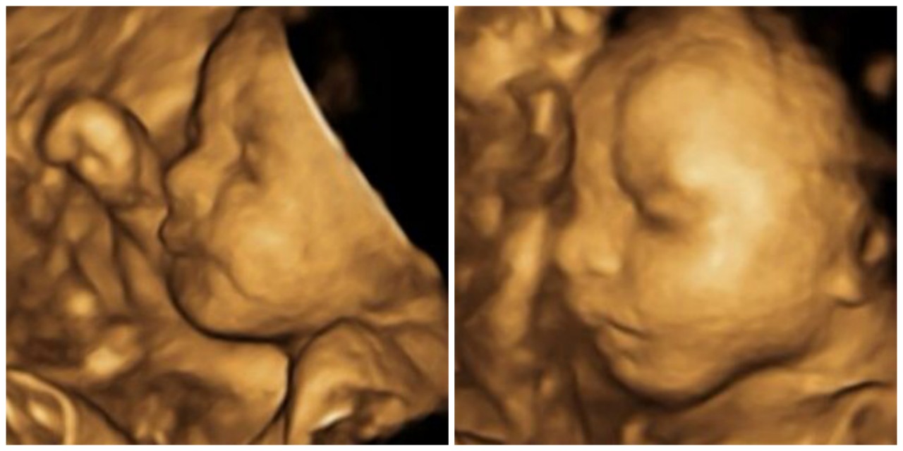 Baby Girl 3D 28 Weeks A Sneak Peek at Mini Madam & Some Bad News (28 Weeks)