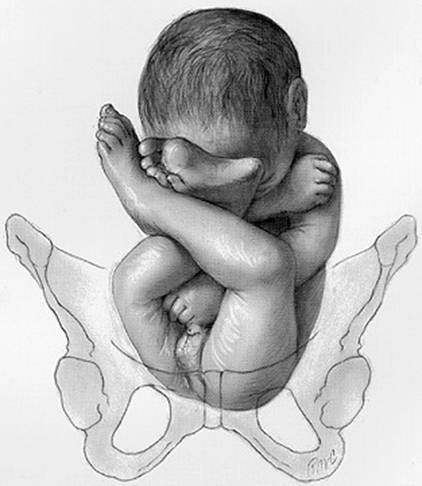 image001 So will it be a c section? (29 weeks pregnant)