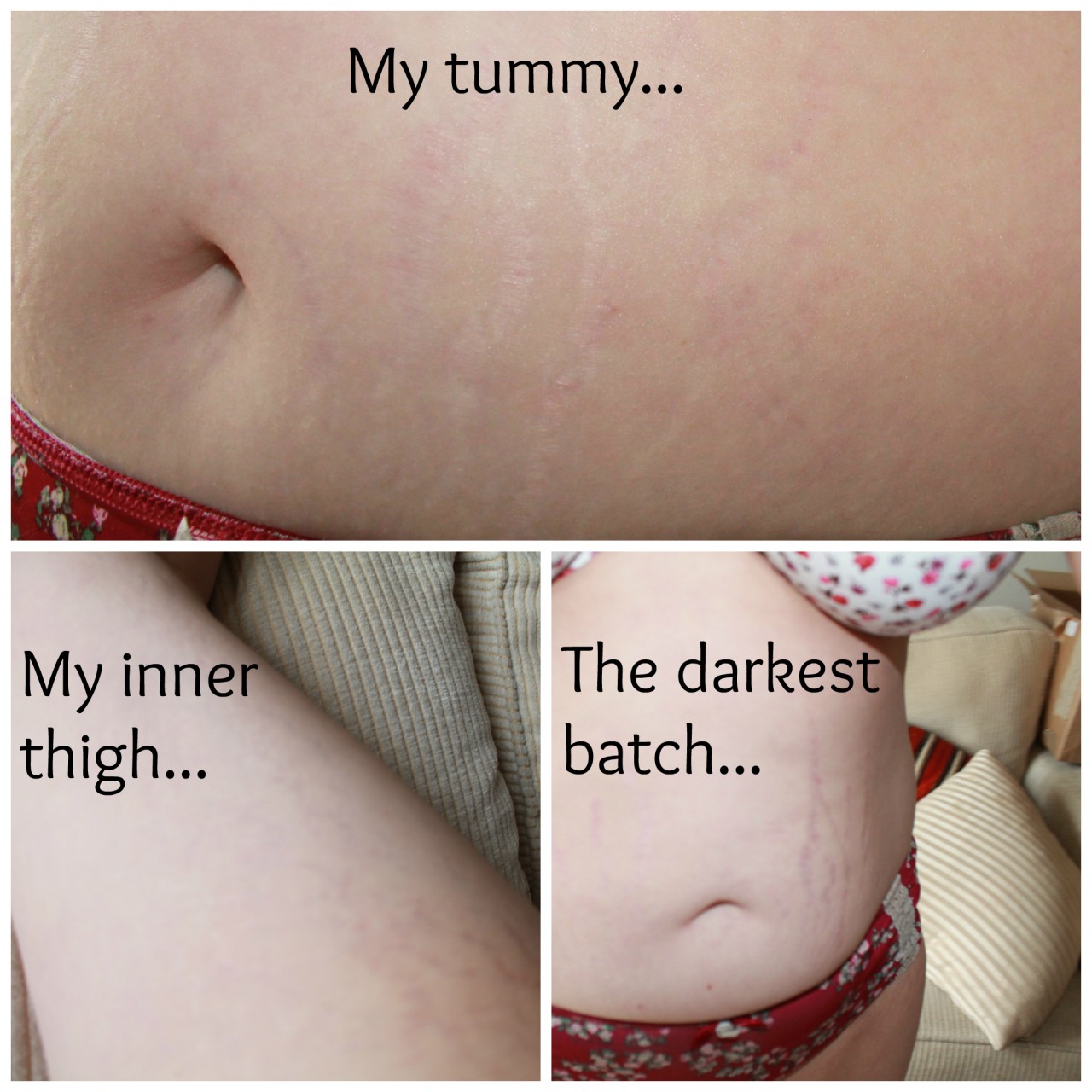 Stretch Marks Bepanthen Stretch Mark Cream Review