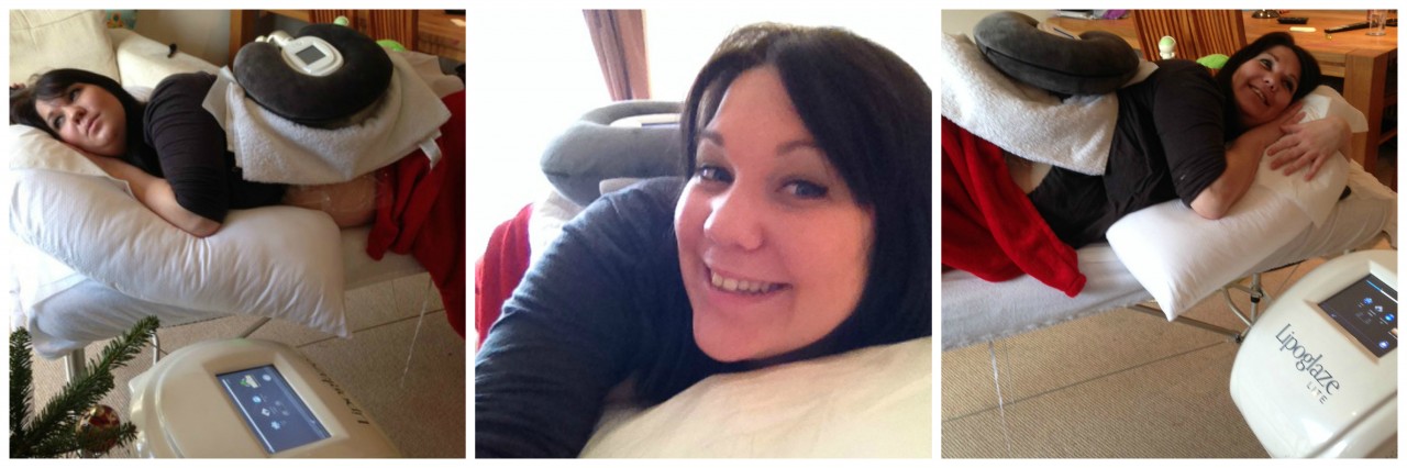 During TreatmentFinal My Sculptlite Fat Freezing Treatment