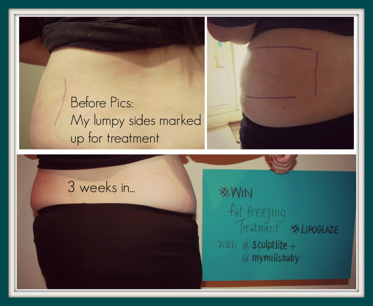 Telfie1 Win Fat Freezing Treatment from Sculptlite worth £295 by Showing us your #Telfie (CD: 31/01/2015)